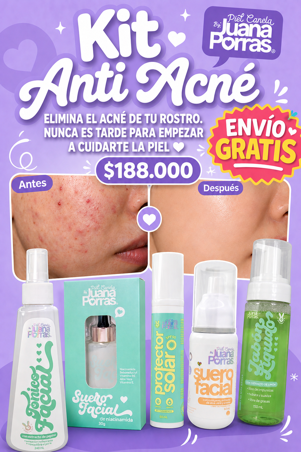 Kit anti acne